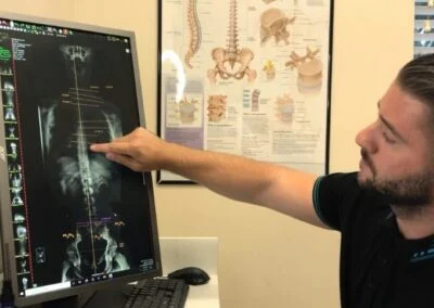 Gonstead Chiropractic Method