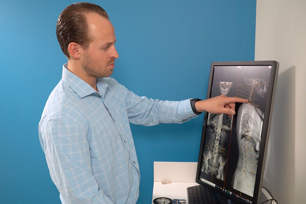 Why Top Chiropractors X-Ray Their Patients Before Treatment?