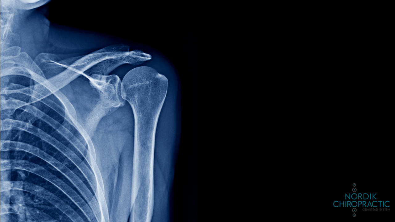 What is Chiropractic Care